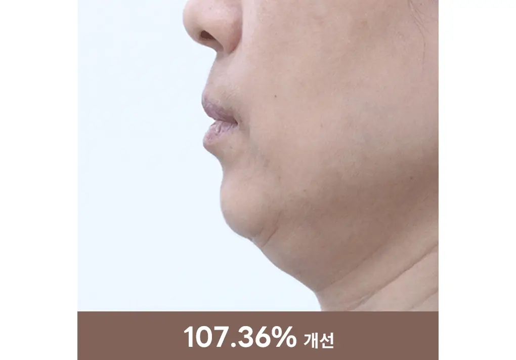 [탄력리프팅/4매] 메디힐 레티놀 콜라겐 윤곽 마스크 2종 (앰플/크림) 상세페이지 34